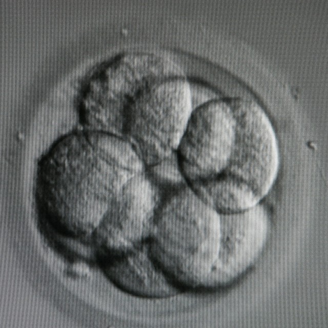 embriyo dondurma
