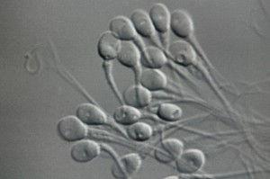 embriyo saklama