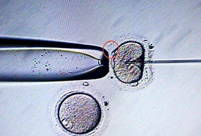 mikroenjeksiyon tüp bebek
